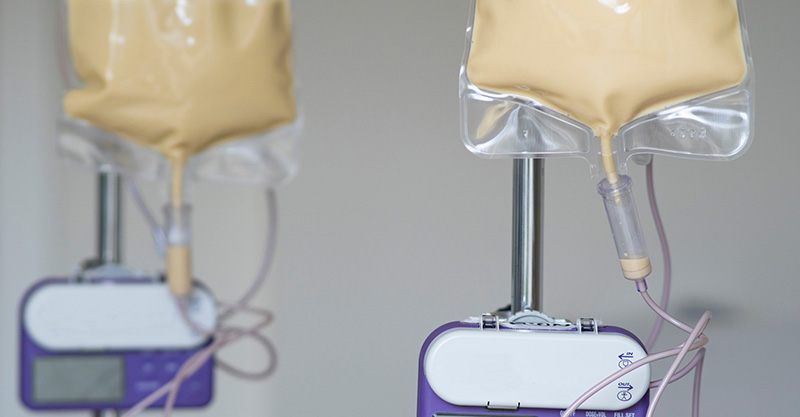 Getting Nutrition through a Feeding Tube