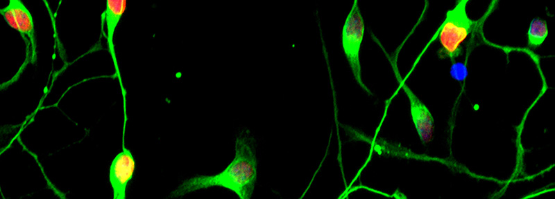 Lou Gehrig Cells