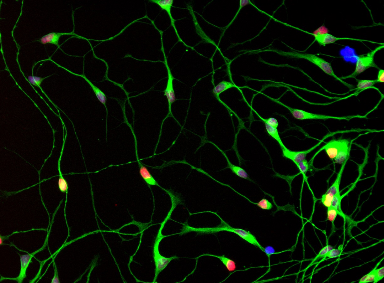 Story: ALS vs MS vs Parkinson's Disease: The Differences Between ...