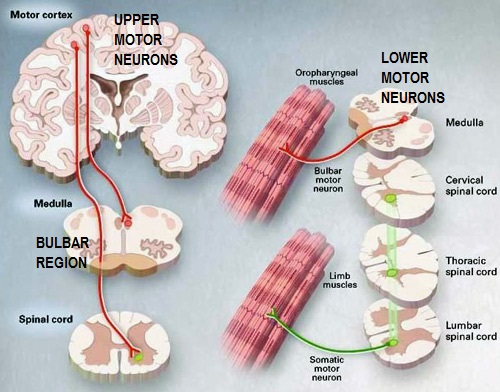 Neurodegenerative Disease by Location