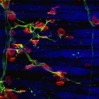 als neuromuscular junction NMJ motor neuron muscle nerve terminal