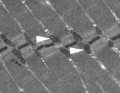 mitochondria skeletal muscle NIH