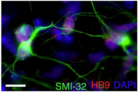 induced motor neurons ALS TDP-43