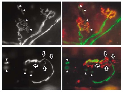 NOGO-A destabilizes neuromuscular junctions
