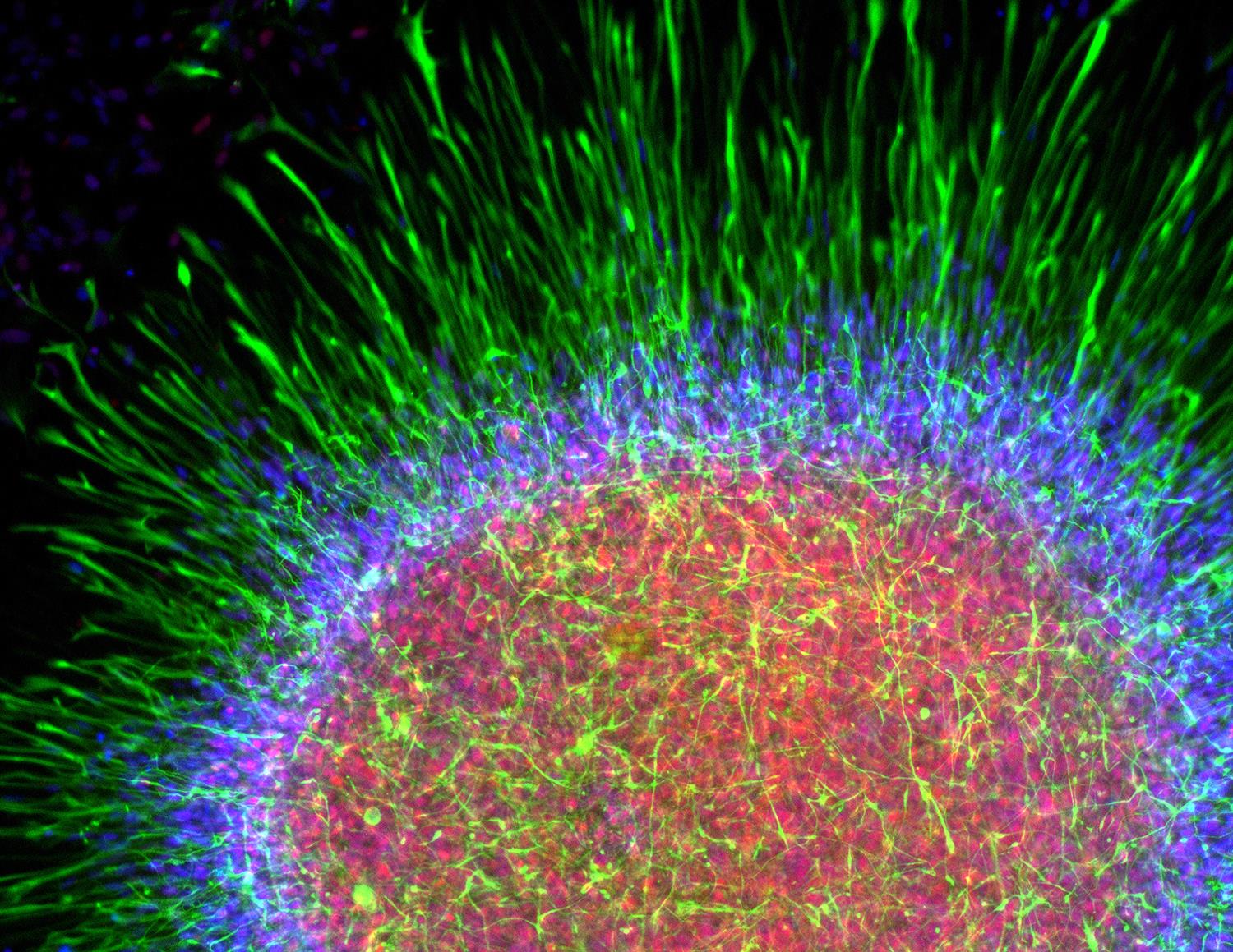 astrocyte iPS krencik zhang