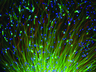 human neural stem cells