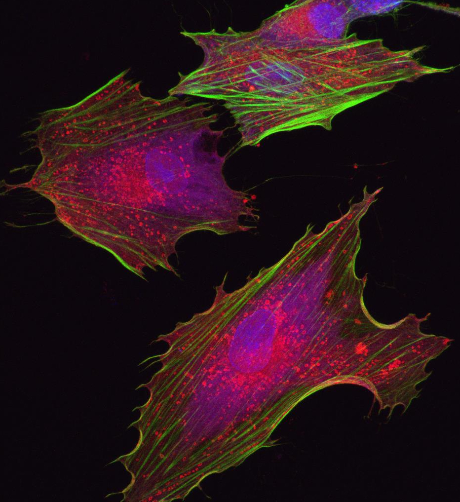 adult mesenchymal stem cells from bone marrow