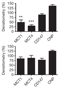 oligodendrocyte axons lactate ALS