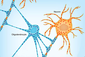oligodendrocyte myelin axons ALS