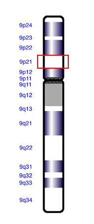 9p21 C9orf72 ALS amyotrophic lateral sclerosis FTD frontotemporal dementia FTLD