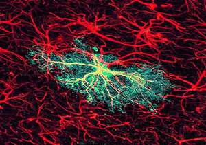 astrocyte als