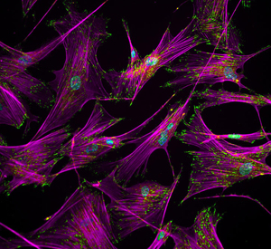 fibroblast reprogramming stem cell ALS