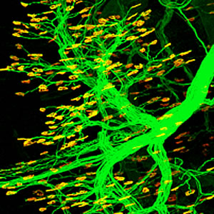 neuromuscular junction NMJ NOGO-A ALS