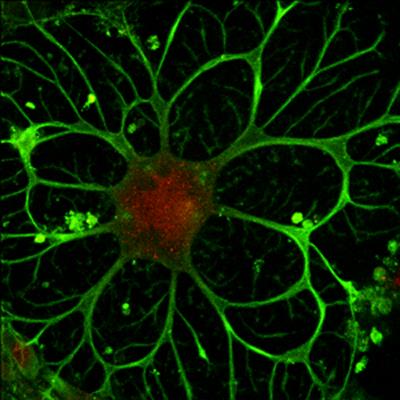 Neural stem cell reprogrammed ips