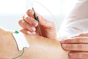 EMG electromyography ALS MND