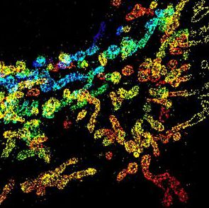 mitochondria dysfunction ALS