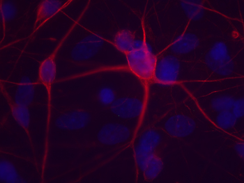 matrix metalloprotease 9 MMP-9 MMP9 inhibitor SB-3CT derivative ALS MND