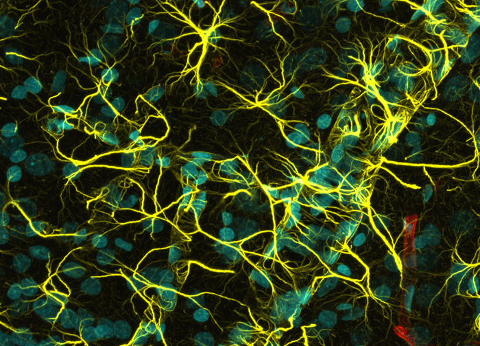 blood brain barrier