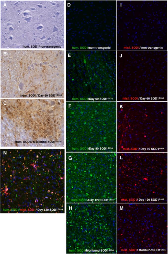 Blog SOD1 protein aggregation predicts slower ALS progression in mouse