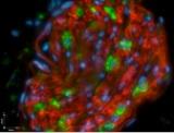 Clinical Trial Update