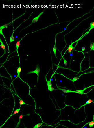 What are the first symptoms of ALS?