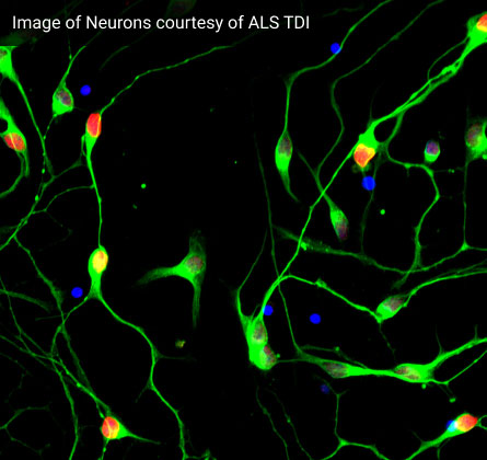 What are the first symptoms of ALS?