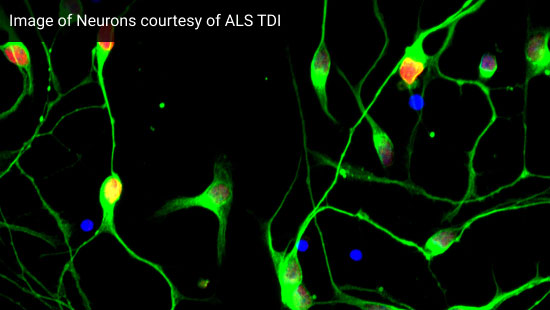 What are the first symptoms of ALS?