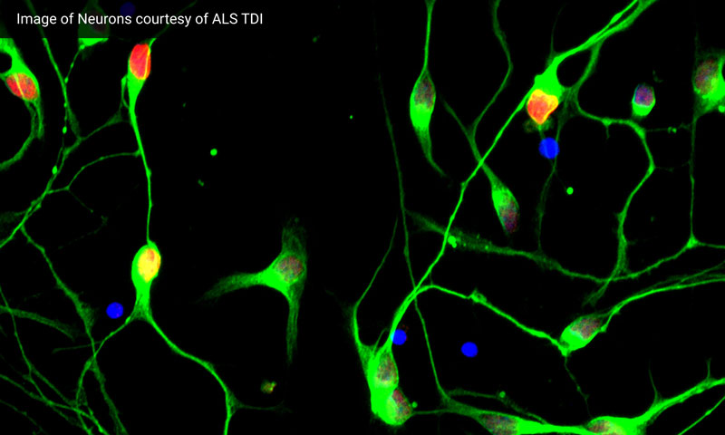 What are the first symptoms of ALS?